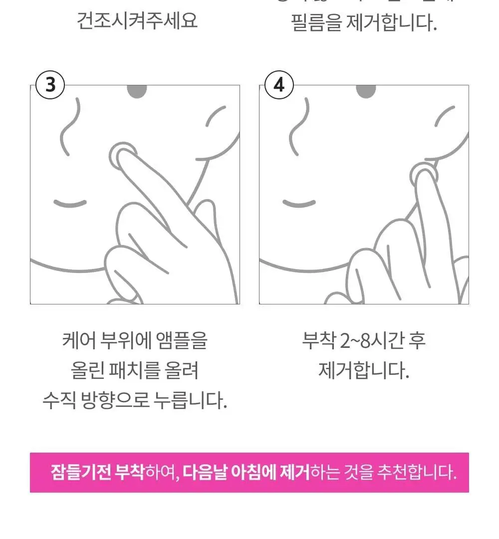 [단하루 초특가/약국 1등] 대웅제약 이지덤 스팟패치 골라담기 택1 (퀵카밍/뷰티/PDRN 주름/릴리프) 트러블패치 상세페이지 88